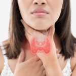 thyroid